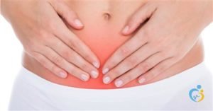 متلازمة احتقان الحوض
