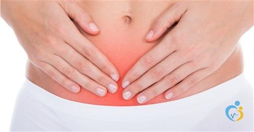 متلازمة احتقان الحوض